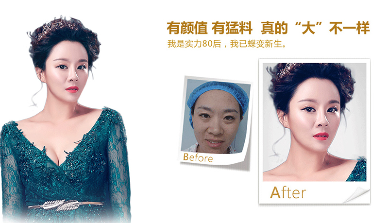 基隆脂肪移植、隆鼻