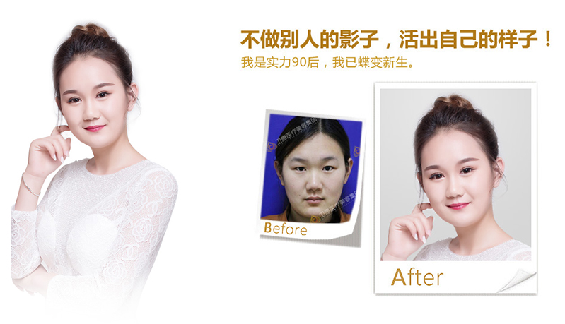 基隆纳米脂肪移植