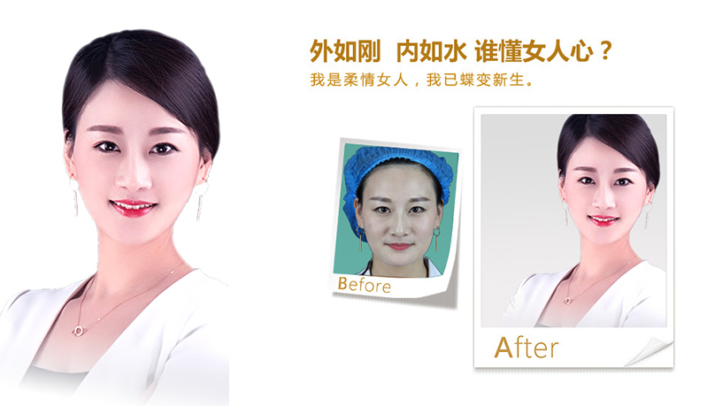 基隆V脸、线雕隆鼻